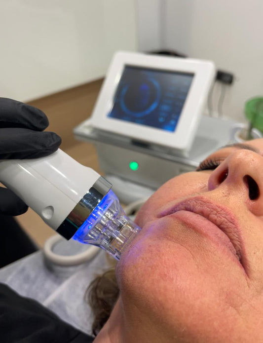 2 Microagujas Fraccionadas x$200